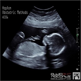 (AE056)HopΛon – Obstetric Methods